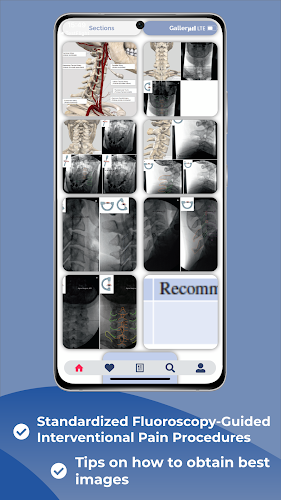 Interventional Pain App स्क्रीनशॉट 2