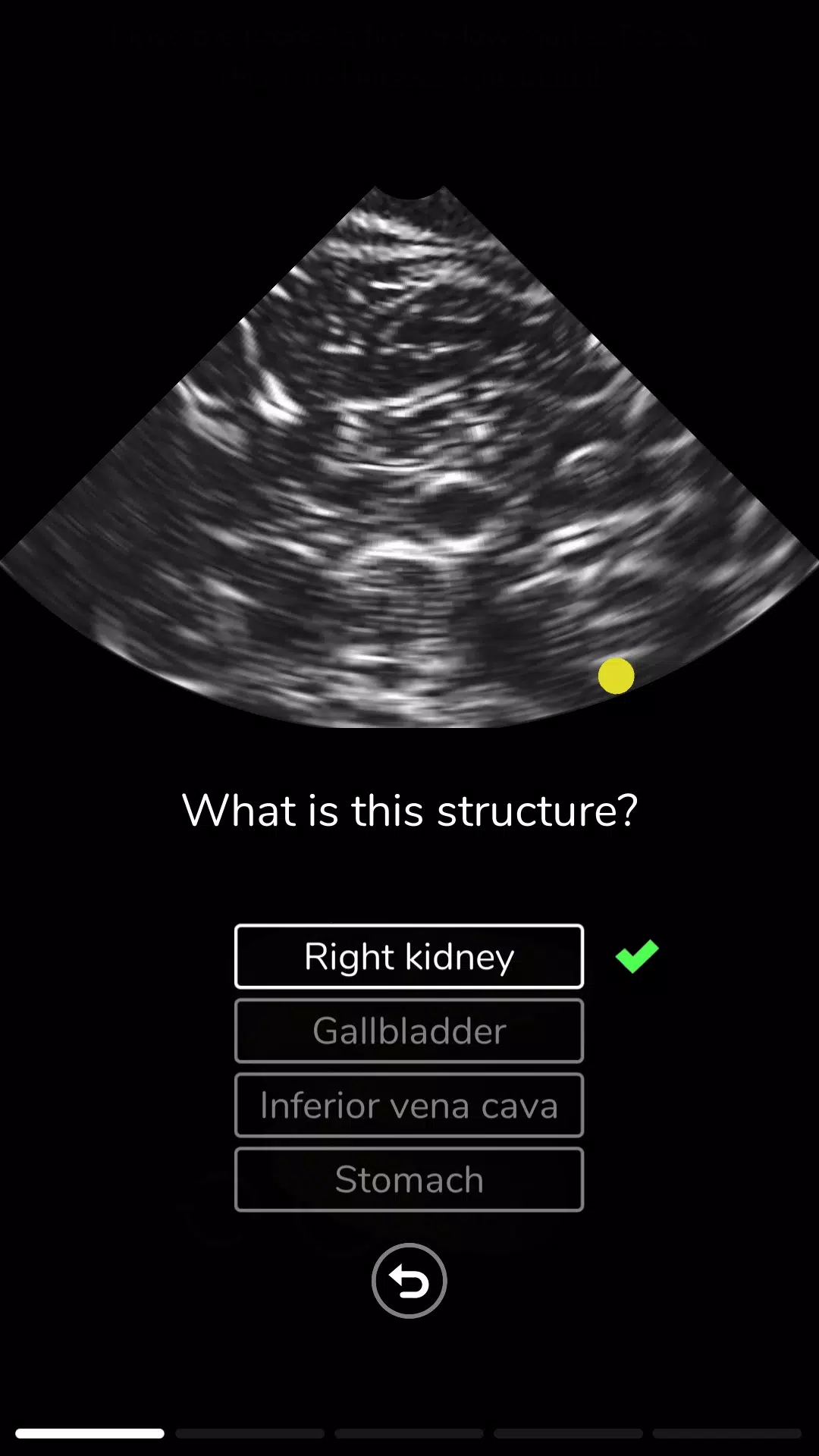 Deepscope Ultrasound Simulator Capture d'écran 3